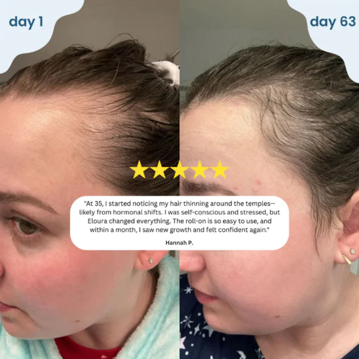 CocoGlam - Advanced Hair Growth Roll-On Serum.