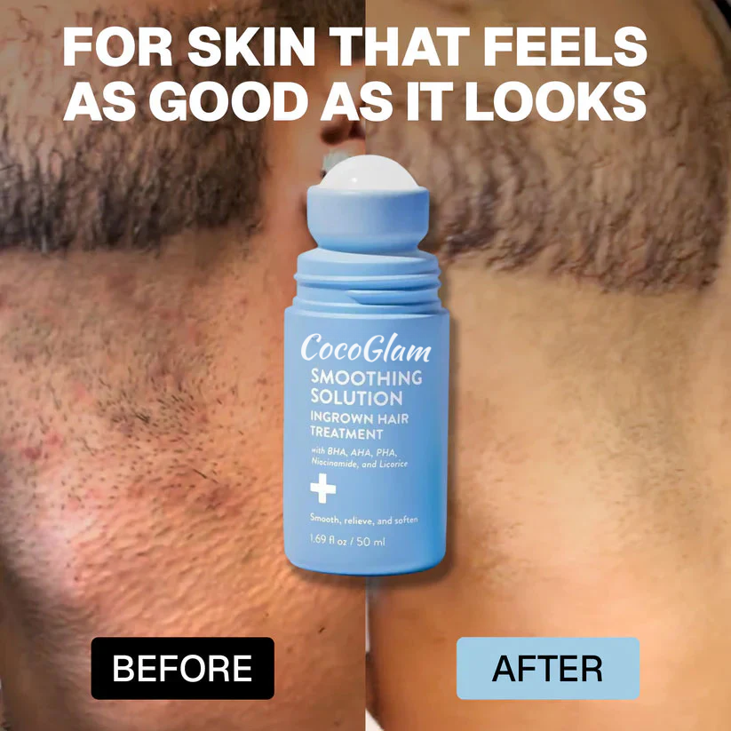 Smoothing Solution Ingrown Hair Treatment