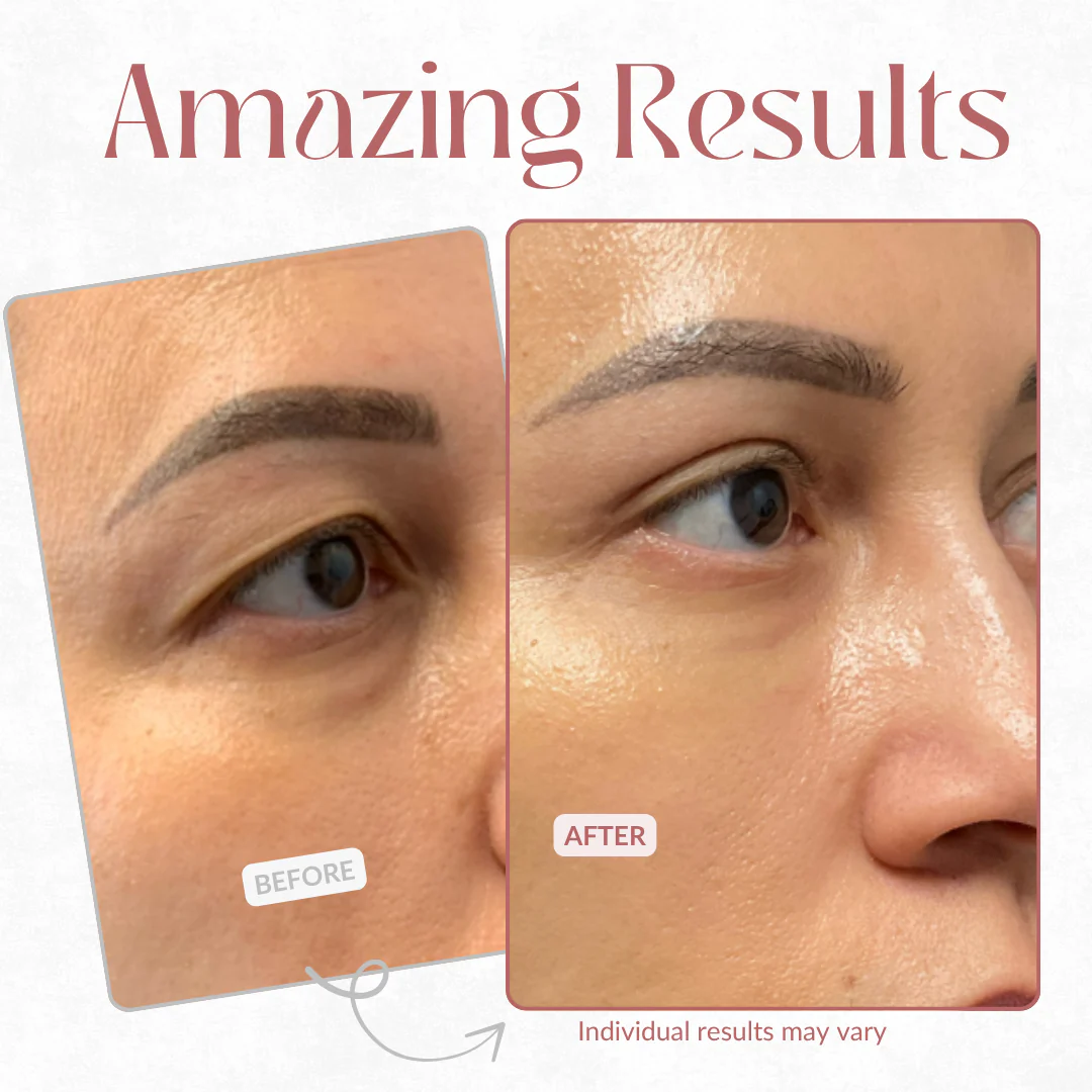 Peptide Collagen Eye Patches (60 Patches)